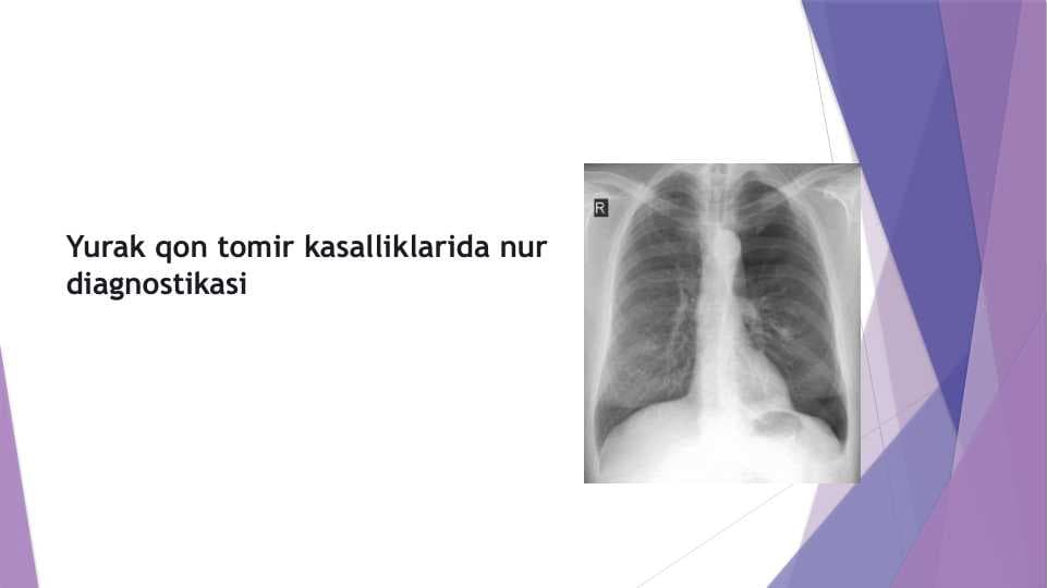 yurak qon tomir nur tekshirish usullari