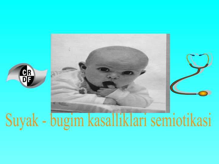 Suyak-bugim kasalliklari semiotikasi