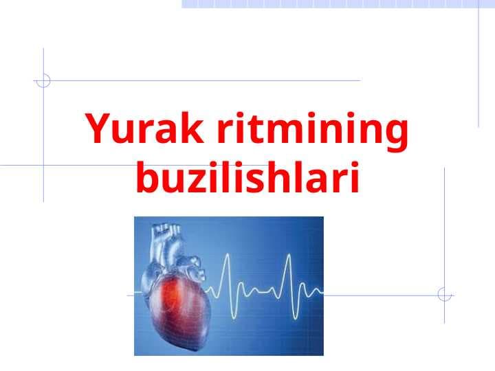 Yurak ritmining buzilishlari