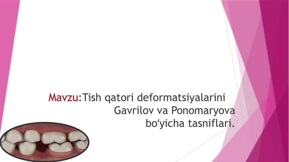 Tish qatori deformatsiyalarini            Gavrilov va Ponomaryova boʻyicha tasniflari