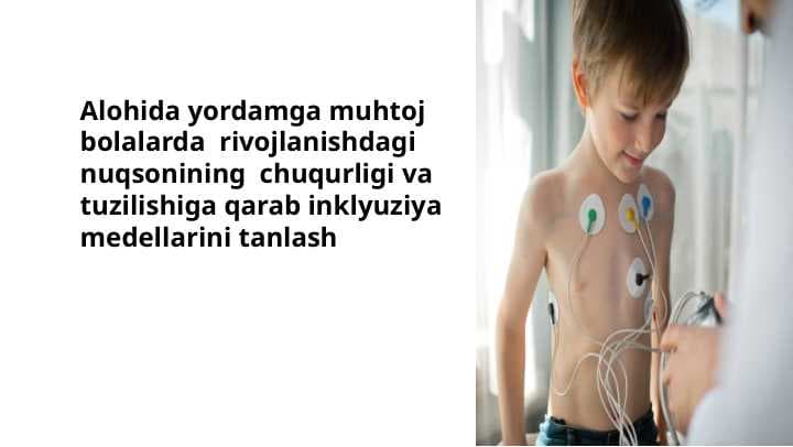 Alohida yordamga muhtoj bolalarda  rivojlanishdagi nuqsonining  chuqurligi va tuzilishiga qarab inklyuziya medellarini tanlash