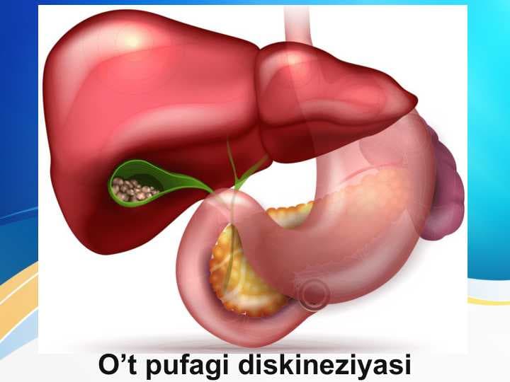 O’t pufagi diskineziyasi