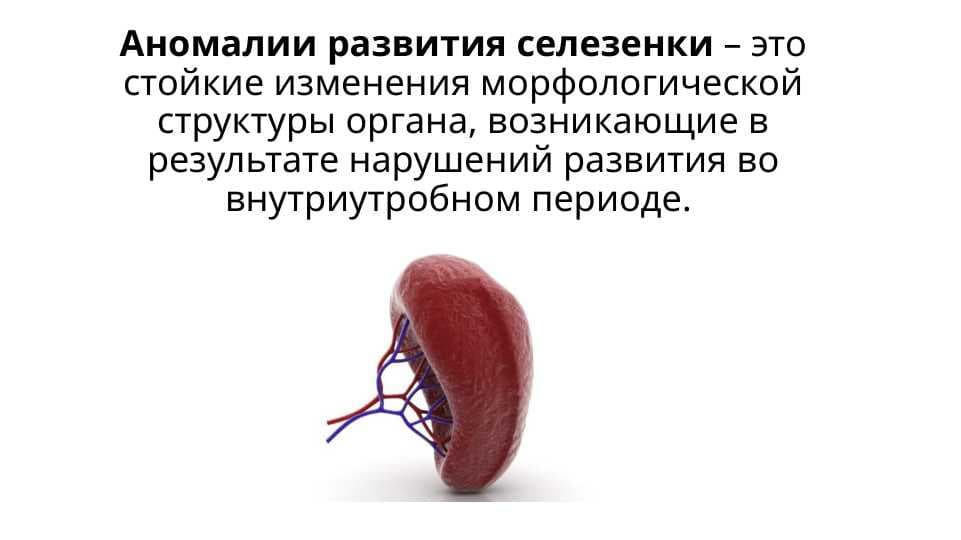 Аномалии развития селезенки