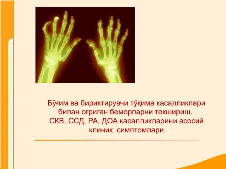 Бўғим ва бириктирувчи тўқима касалликлари билан оғриган беморларни текшириш. СКВ, ССД, РА, ДОА касалликларини асосий клиник  симптомлари