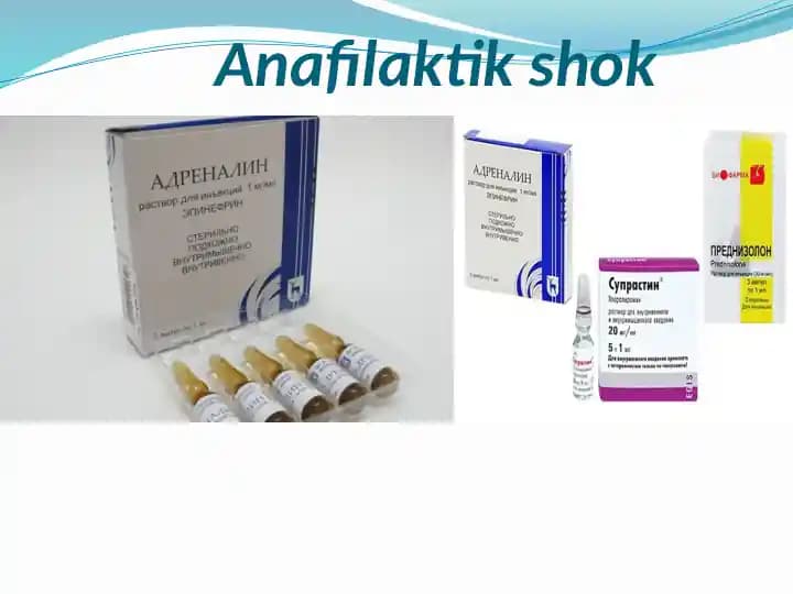 Anafilaktik shok