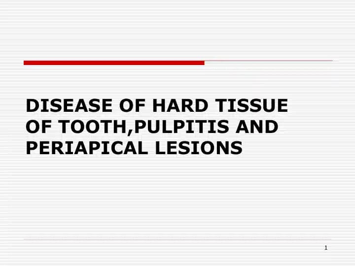 DISEASE OF HARD TISSUE OF TOOTH,PULPITIS AND PERIAPICAL LESIONS