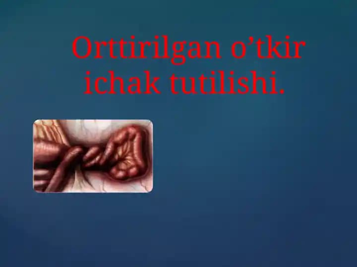 Orttirilgan o’tkir ichak tutilishi