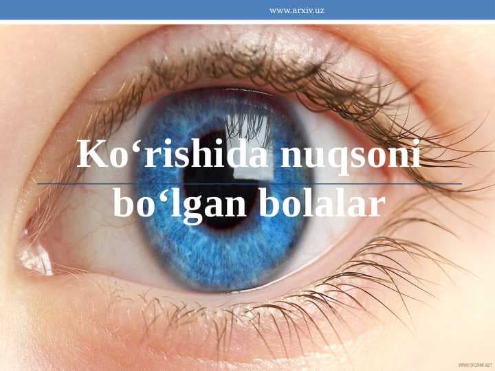 Ko‘rishida nuqsoni bo‘lgan bolalar