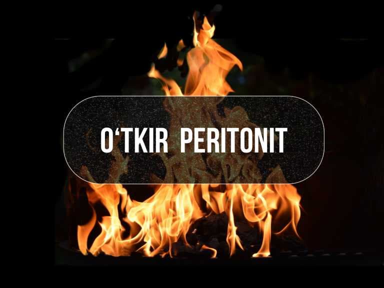 O‘tkir peritonit