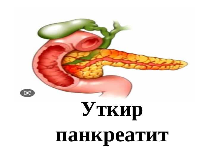 Уткир панкреатит