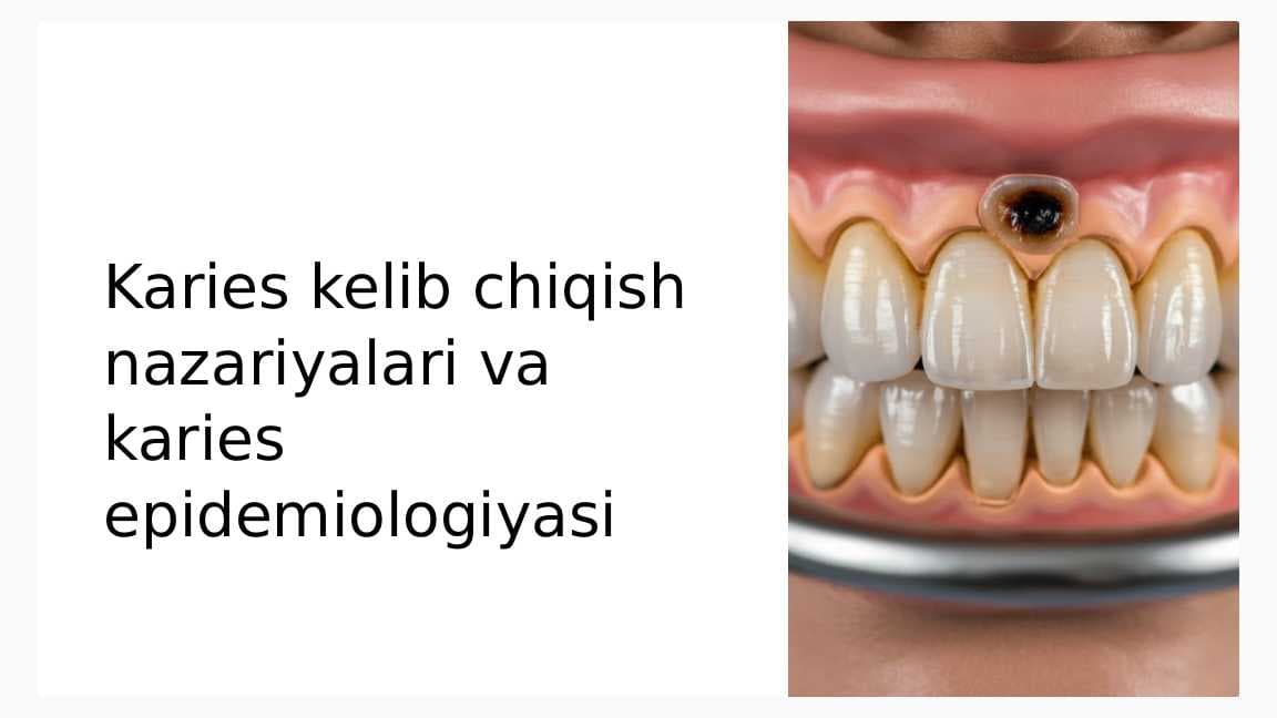 Karies kelib chiqish nazariyalari.  Karies epidemiologiyasi.