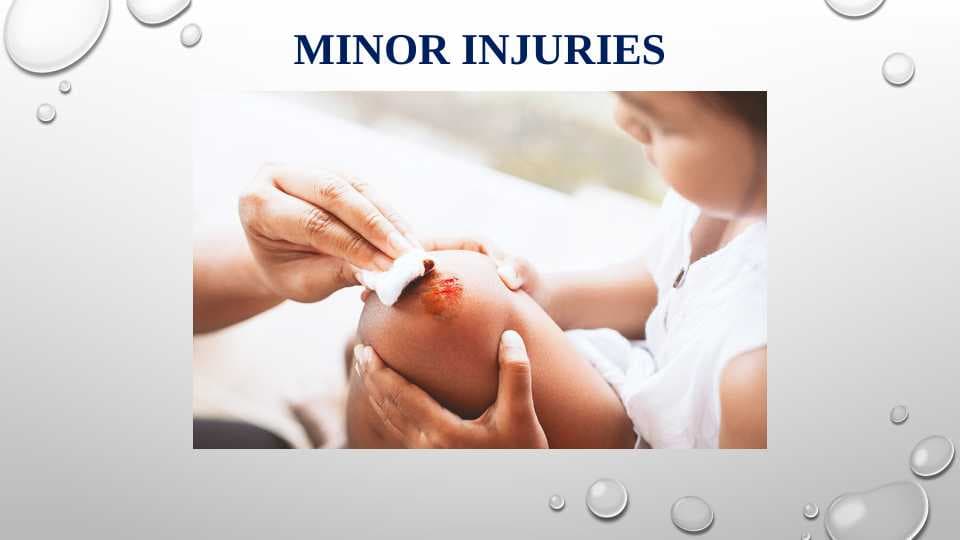 Minor Injuries
