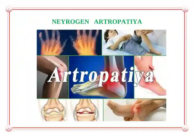 Neyrogen Artropatiya