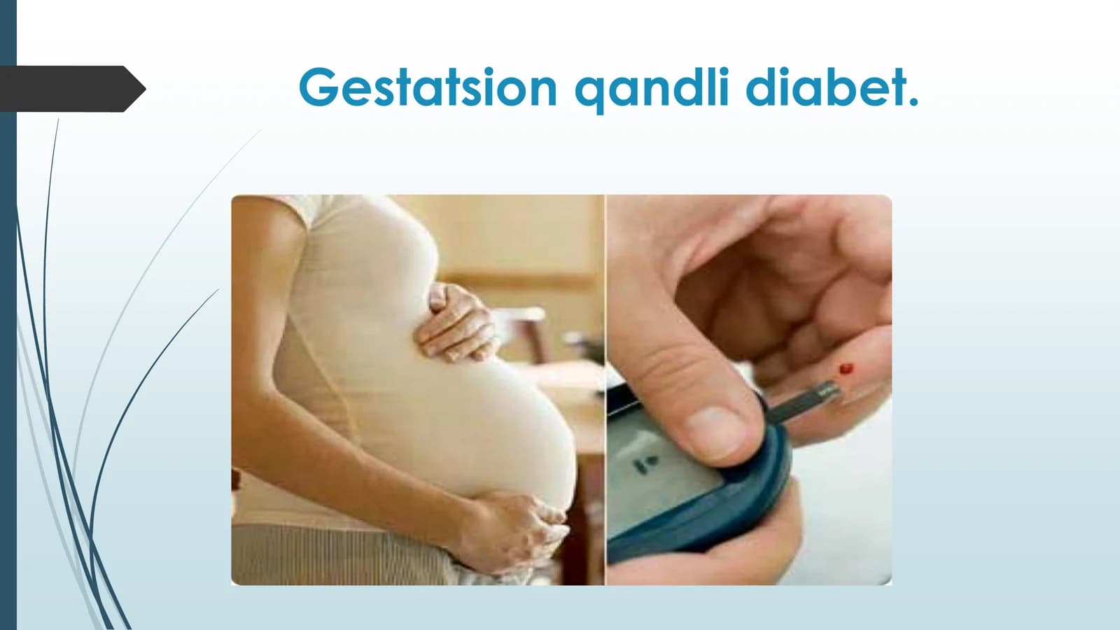 Gestatsion qandli diabet