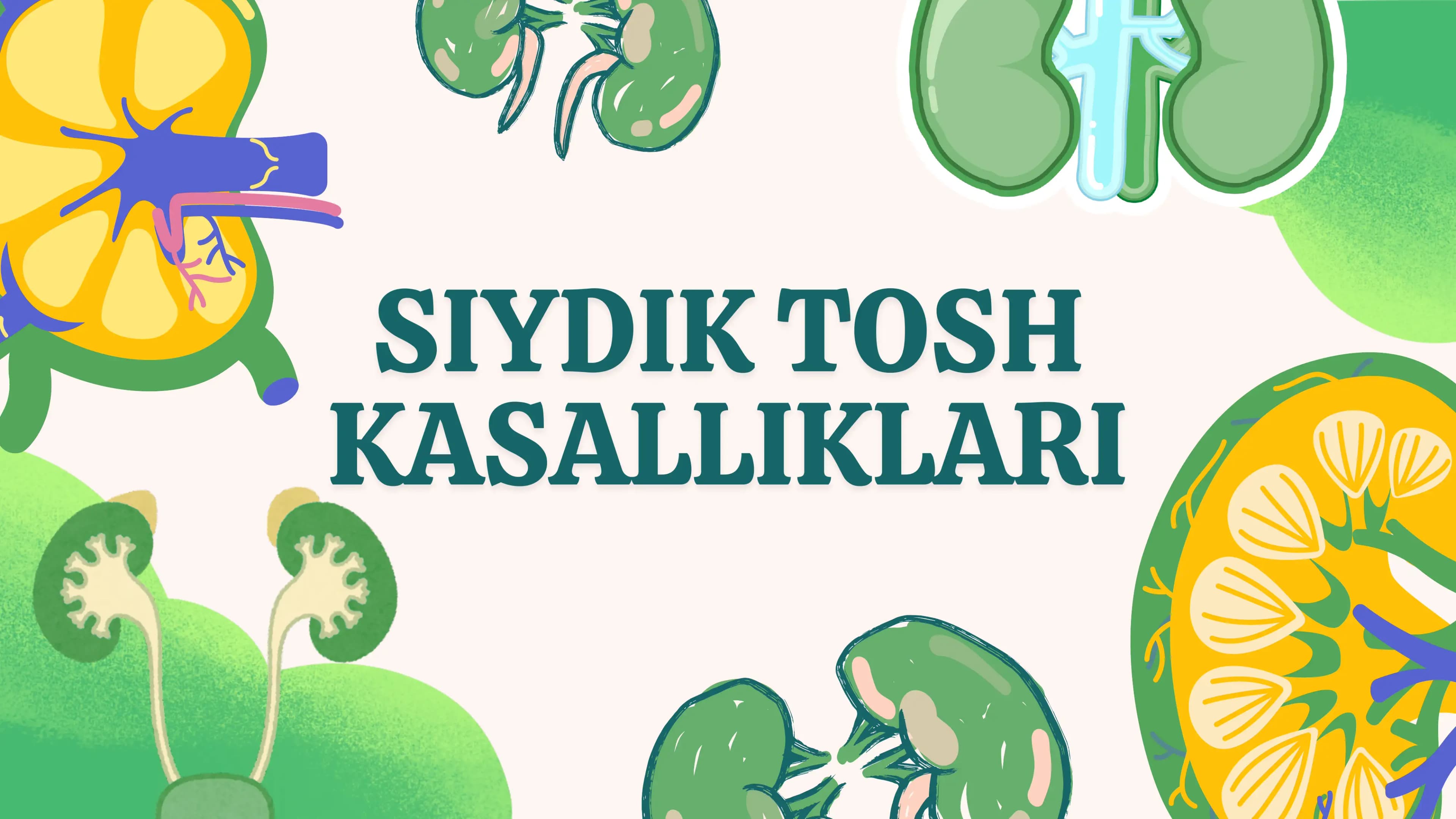 SIYDIK TOSH KASALLIKLARI