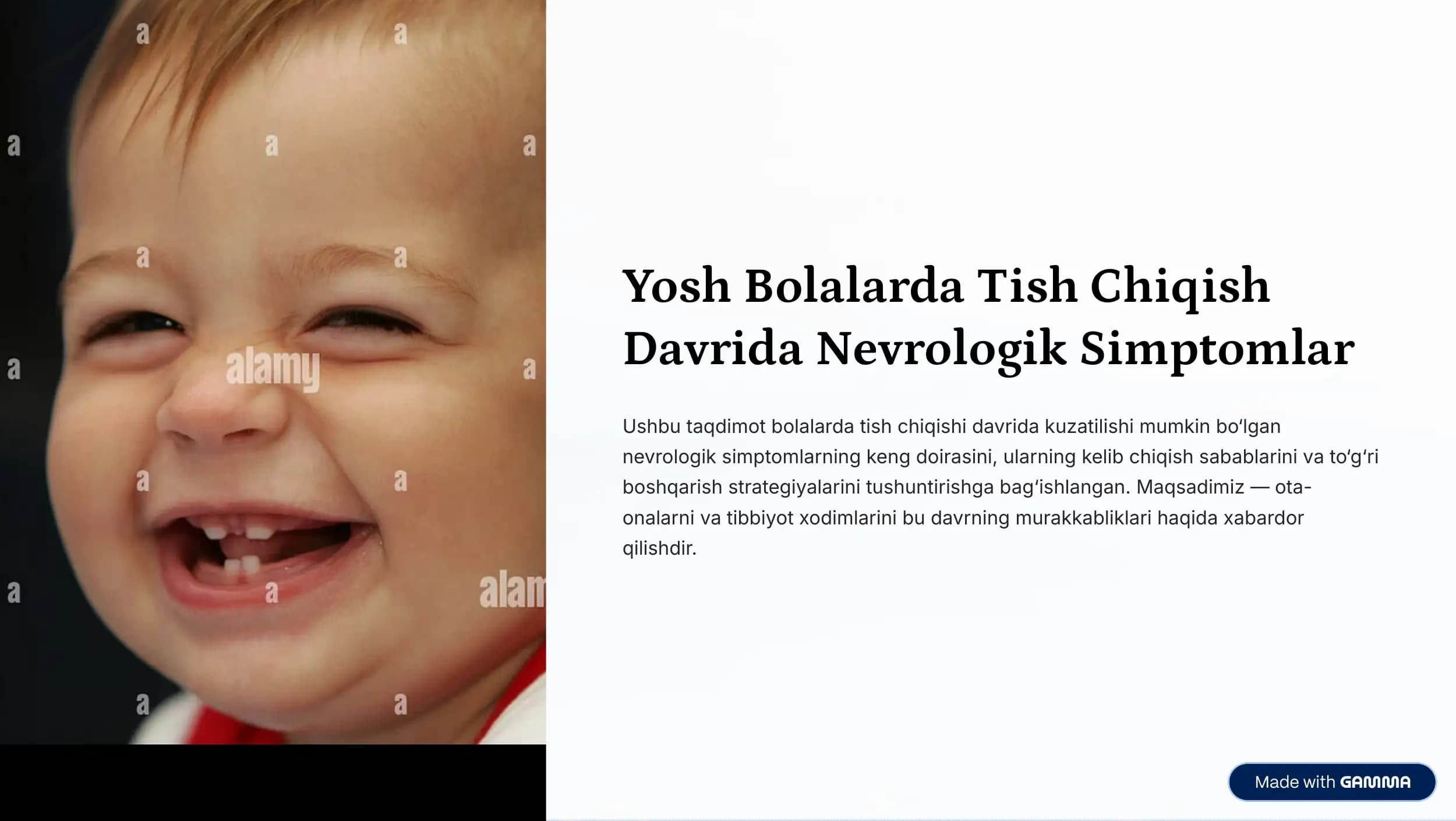Yosh Bolalarda Tish Chiqish 
Davrida Nevrologik Simptomlar