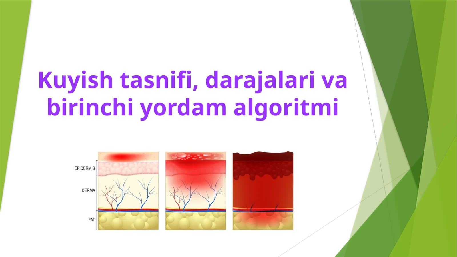 Kuyish tasnifi, darajalari va birinchi yordam algoritmi