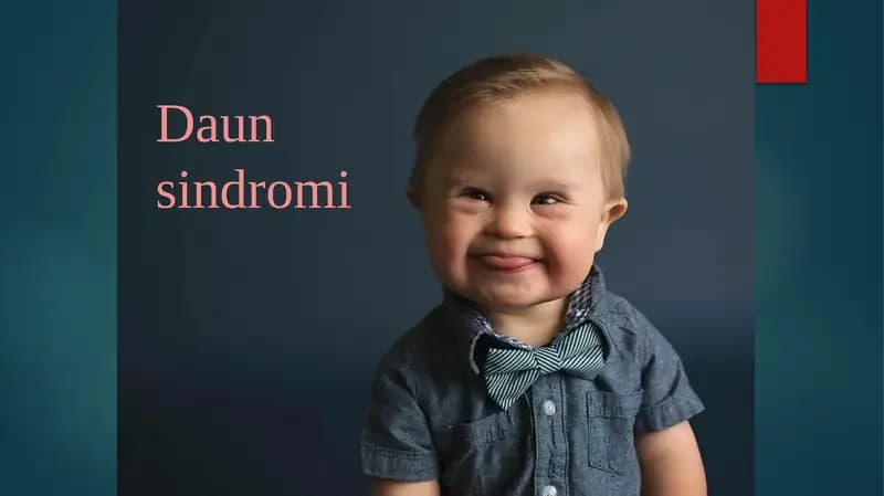 Daun sindromi