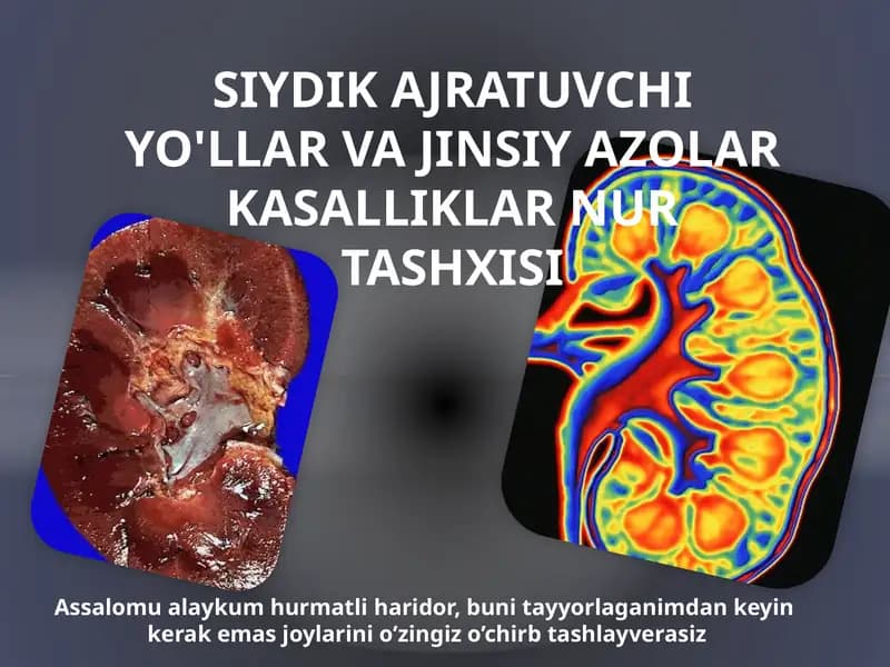 SIYDIK AJRATUVCHI YO'LLAR VA JINSIY AZOLAR KASALLIKLAR NUR TASHXISI