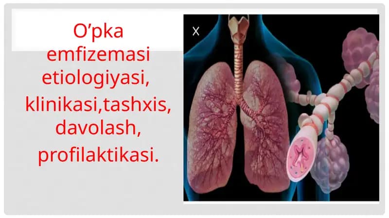 O’pkaemfizemasi etiologiyasi, klinikasi, tashxis, davolash, profilaktikasi