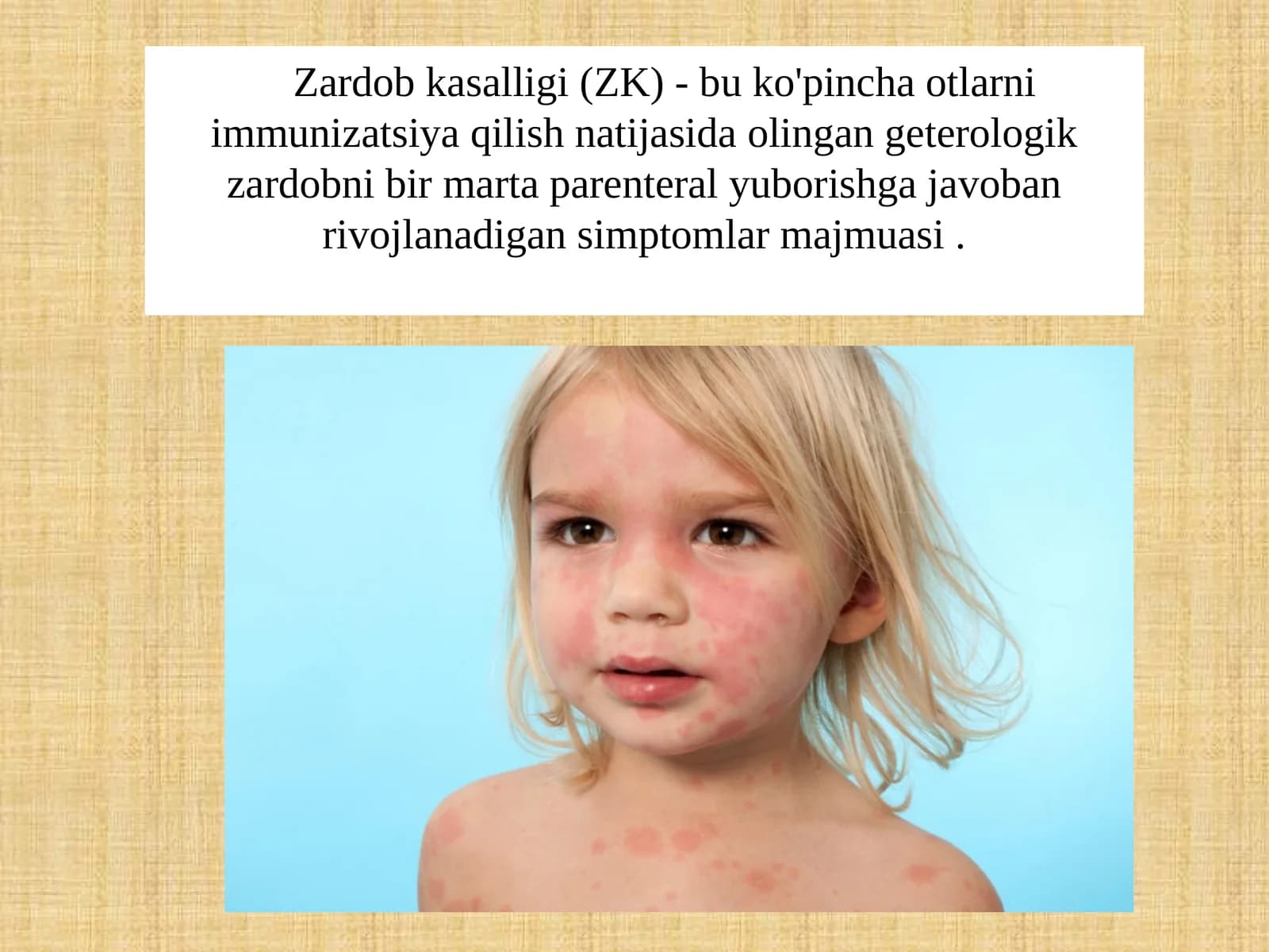 Zardobkasalligi (ZK)