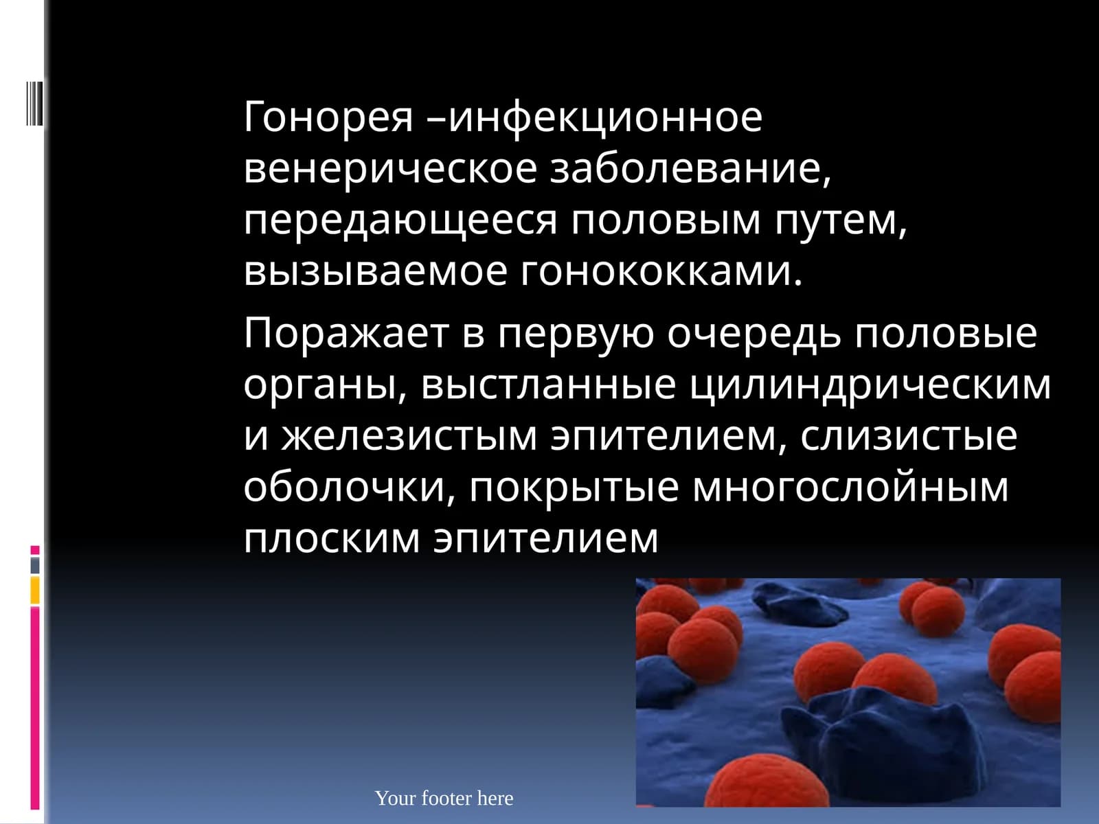 Гонорея