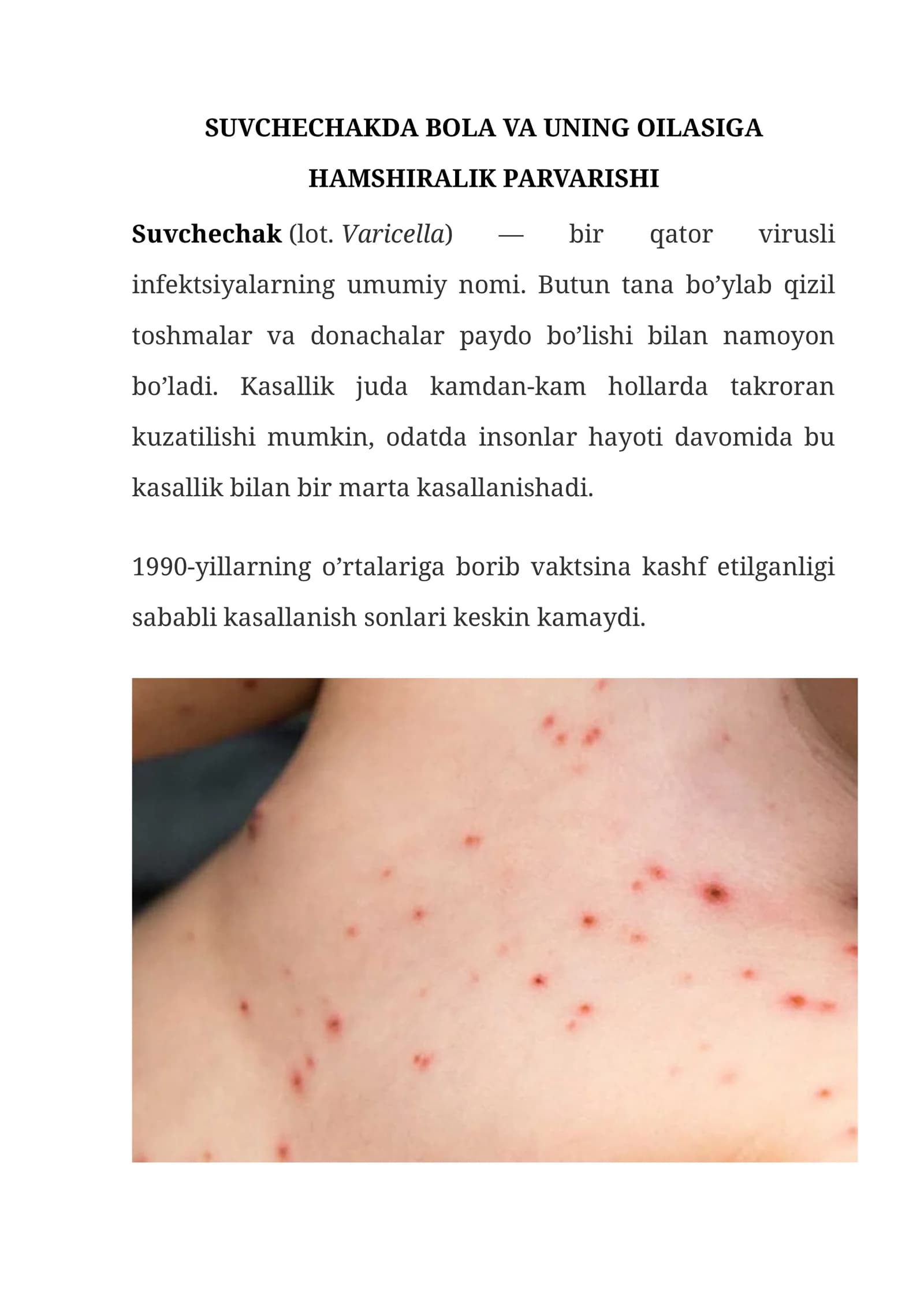 Suvchechakda bola va uning oilasi