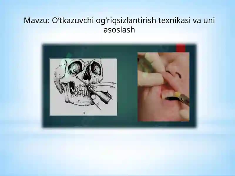 Oʻtkazuvchi ogʻriqsizlantirish texnikasi va uniasoslash