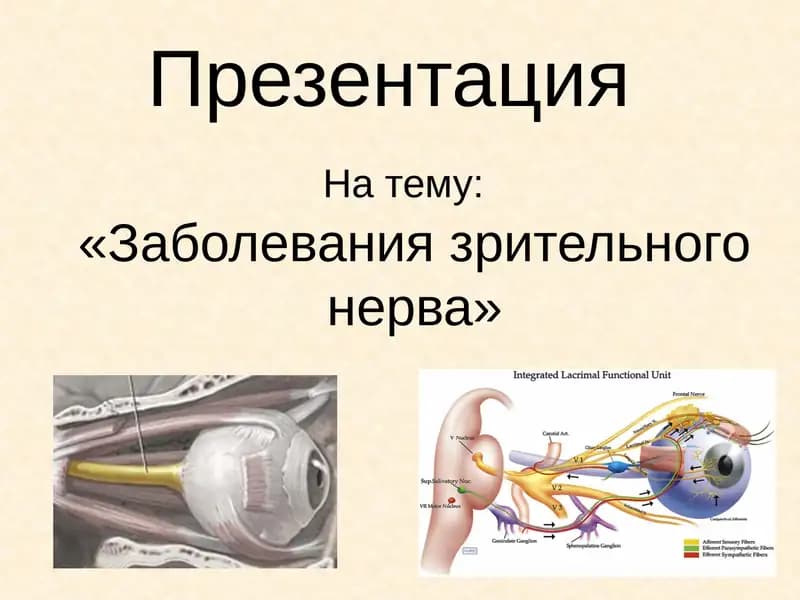 Заболевания зрительного нерва