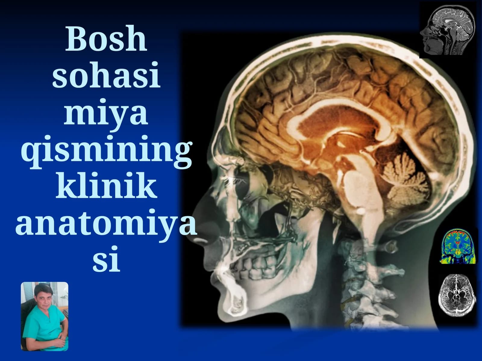Bosh sohasi miya qismining klinik anatomiyasi