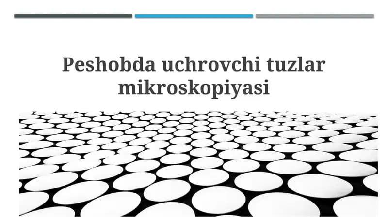 Kristalluriya va siydik cho'kmasi mikroskopiyasi