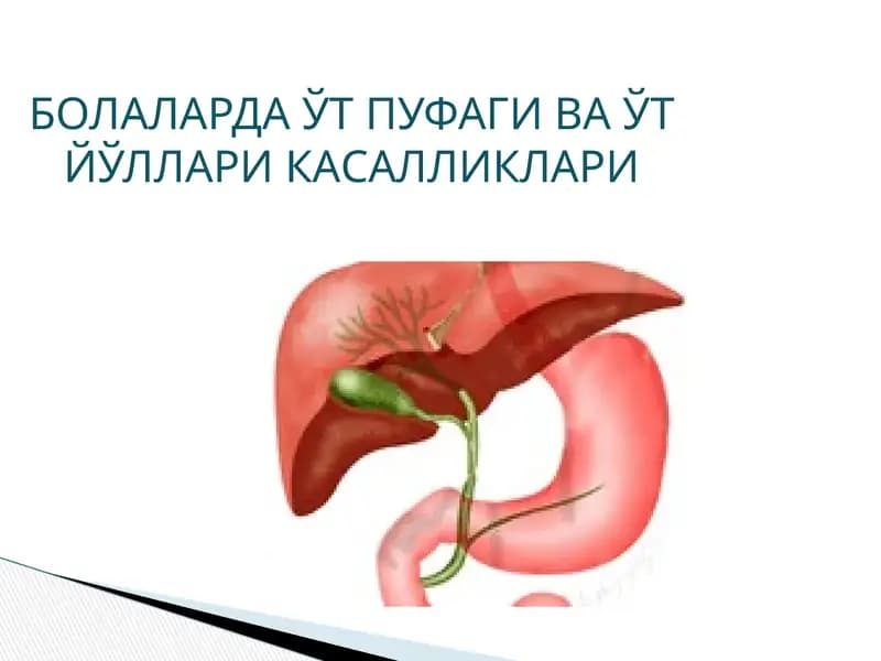 Холецистит