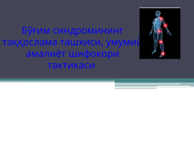 Бўғим синдроми