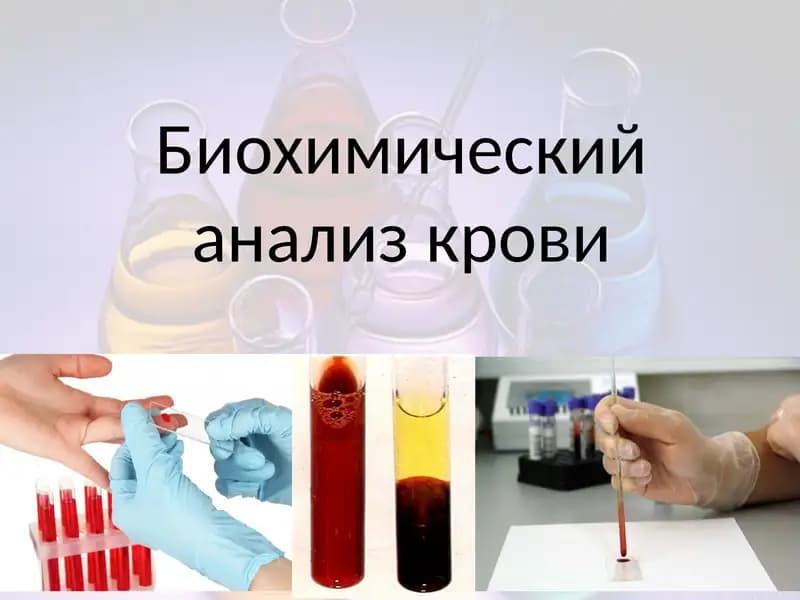 Биохимический анализ крови