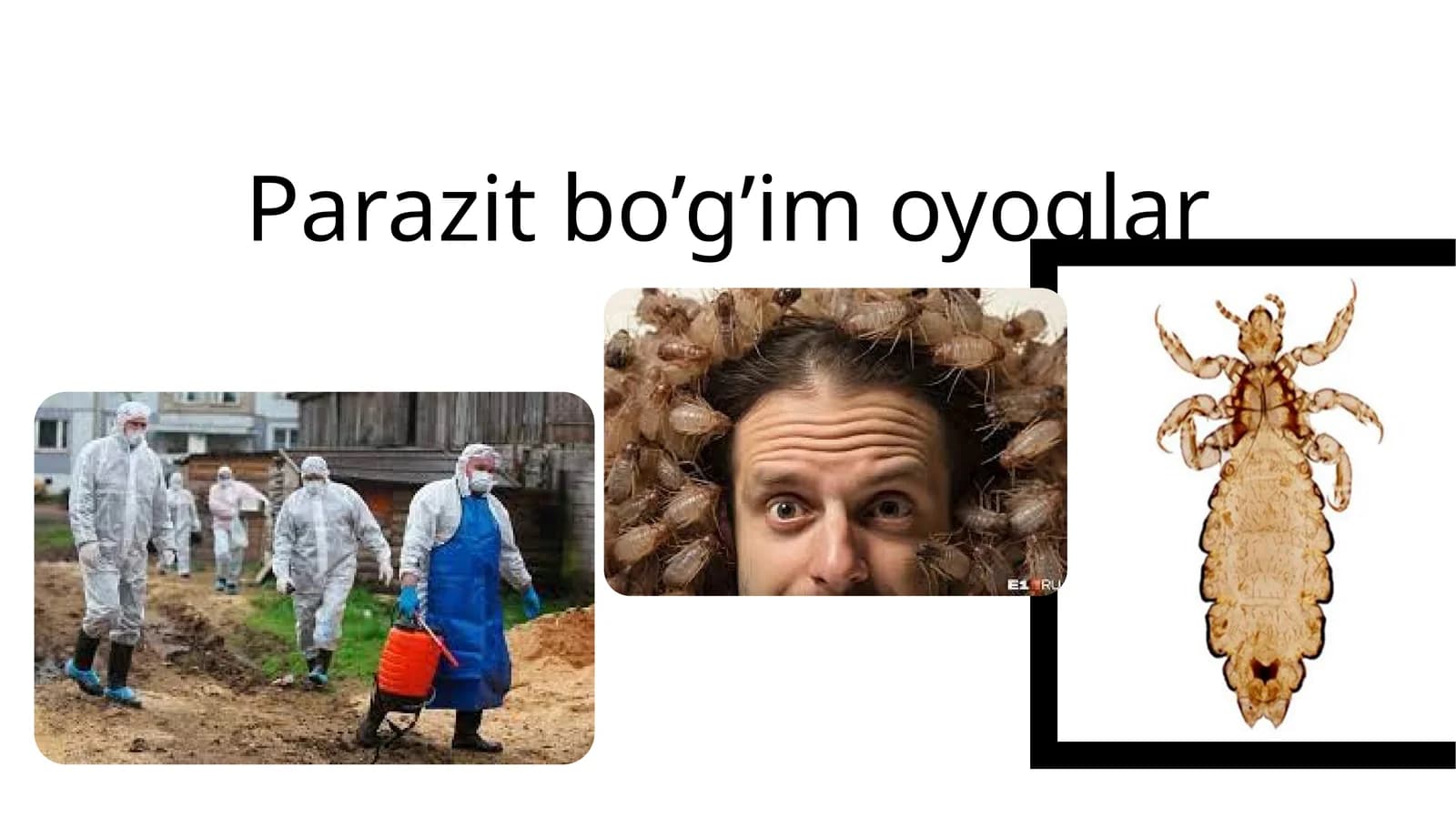 Parazitbo’g’imoyoqlar