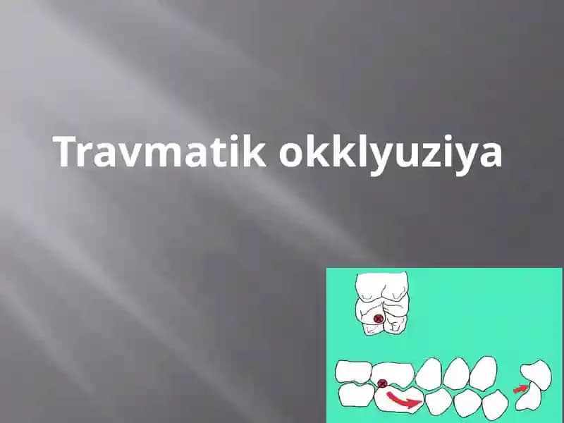Travmatikokklyuziya