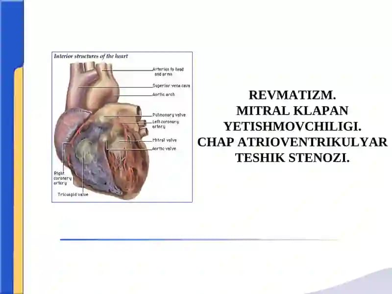 REVMATIZM.MITRAL KLAPAN YETISHMOVCHILIGI.CHAP ATRIOVENTRIKULYAR TESHIK STENOZІ.