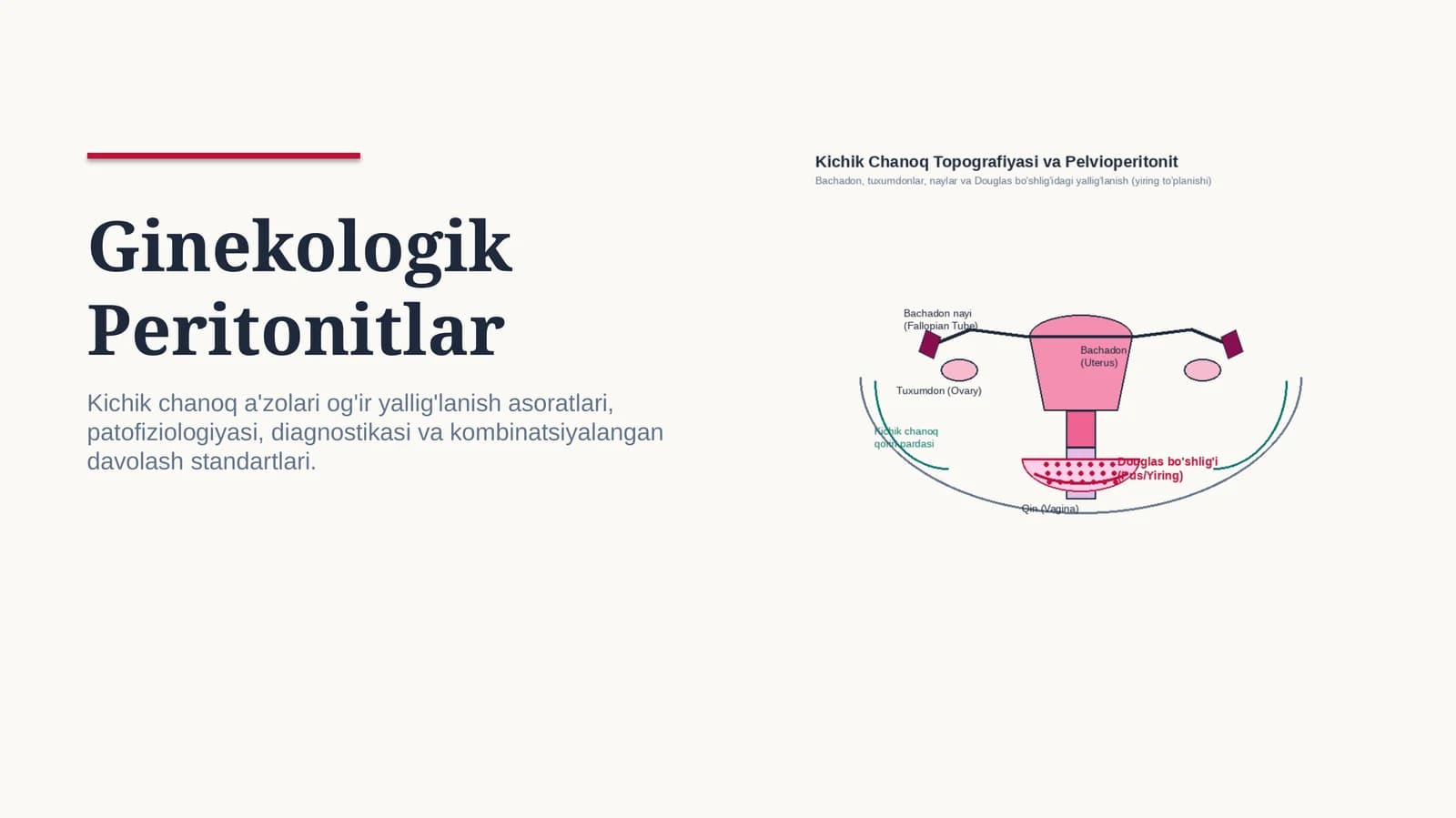 Ginekologik peritonitlar — 15 slaydli professional tibbiy taqdimot | Ginekologiya va akusherlik