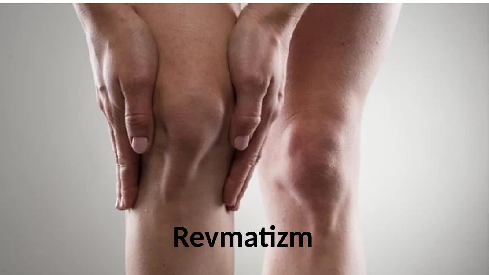 Revmatizm nima. Kasallik haqida umumiy ma’lumot