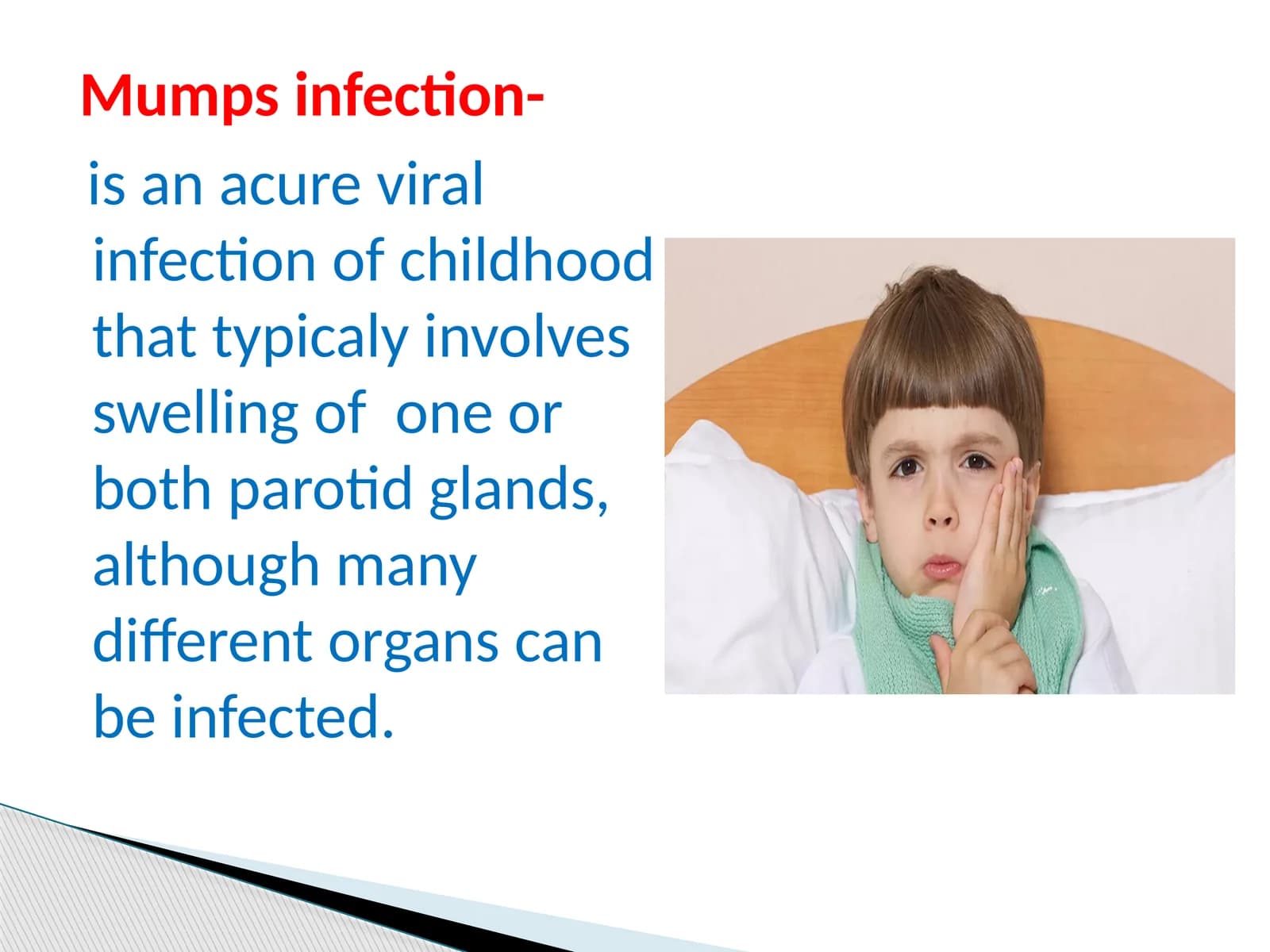 Mumps infection