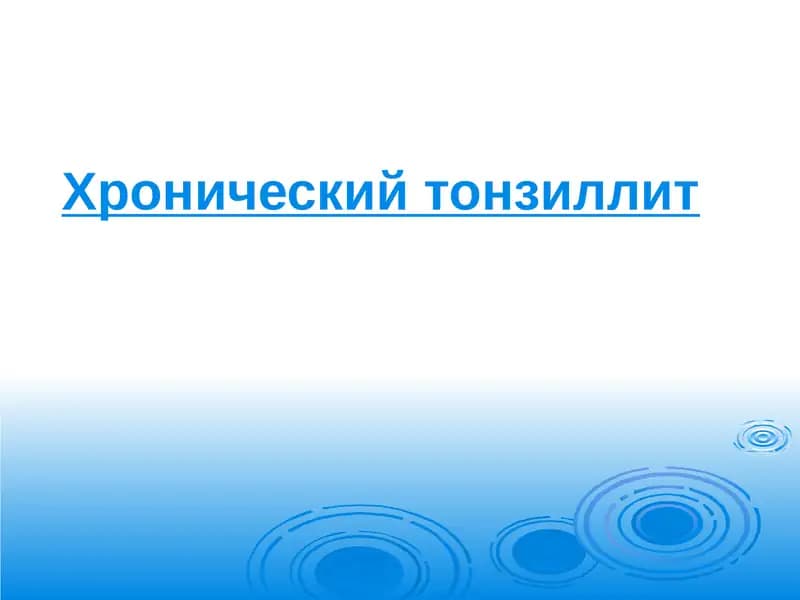 Хронический тонзиллит