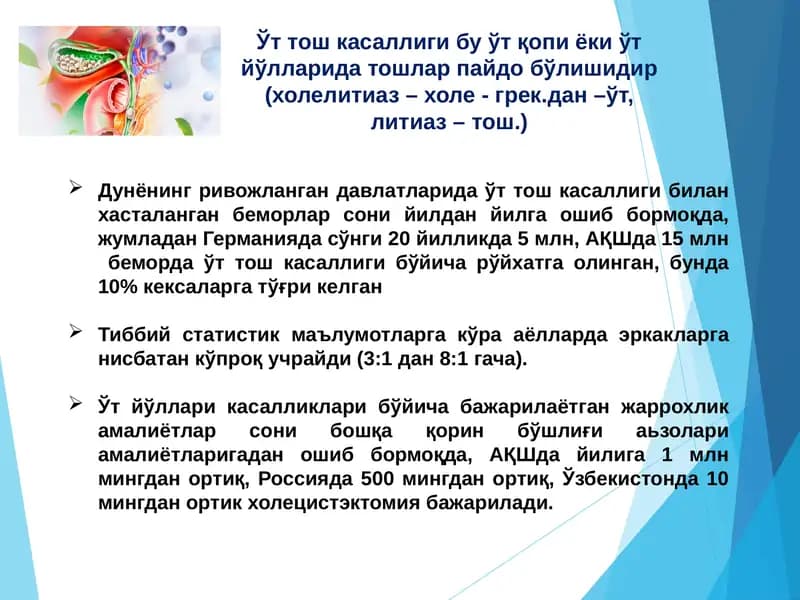 Ўт тош касаллиги