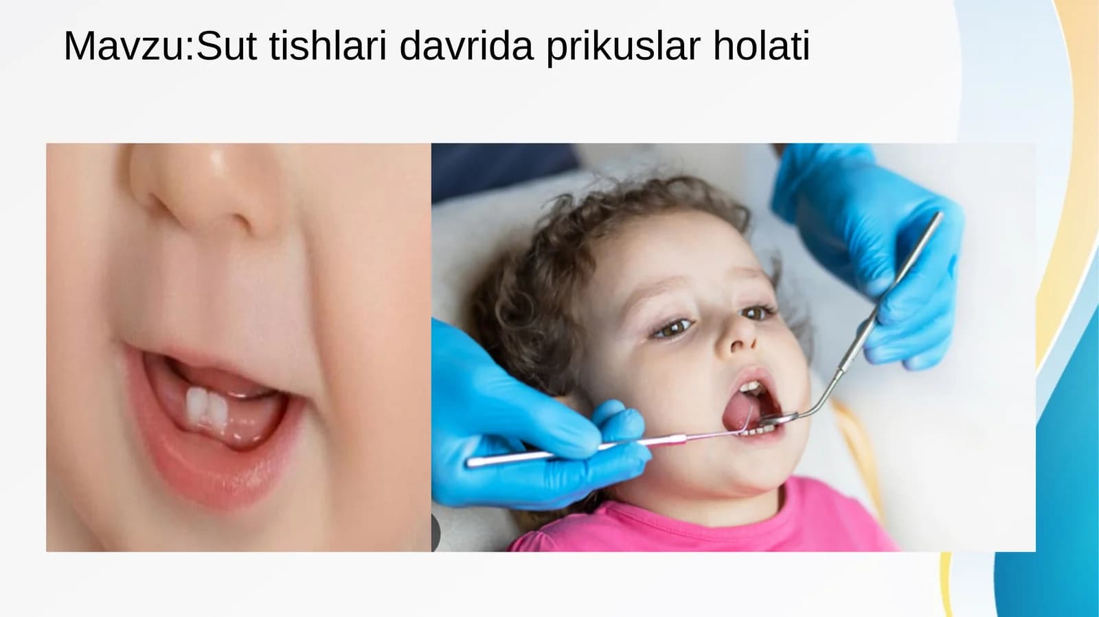 Sut tishlari davrida prikuslar holati