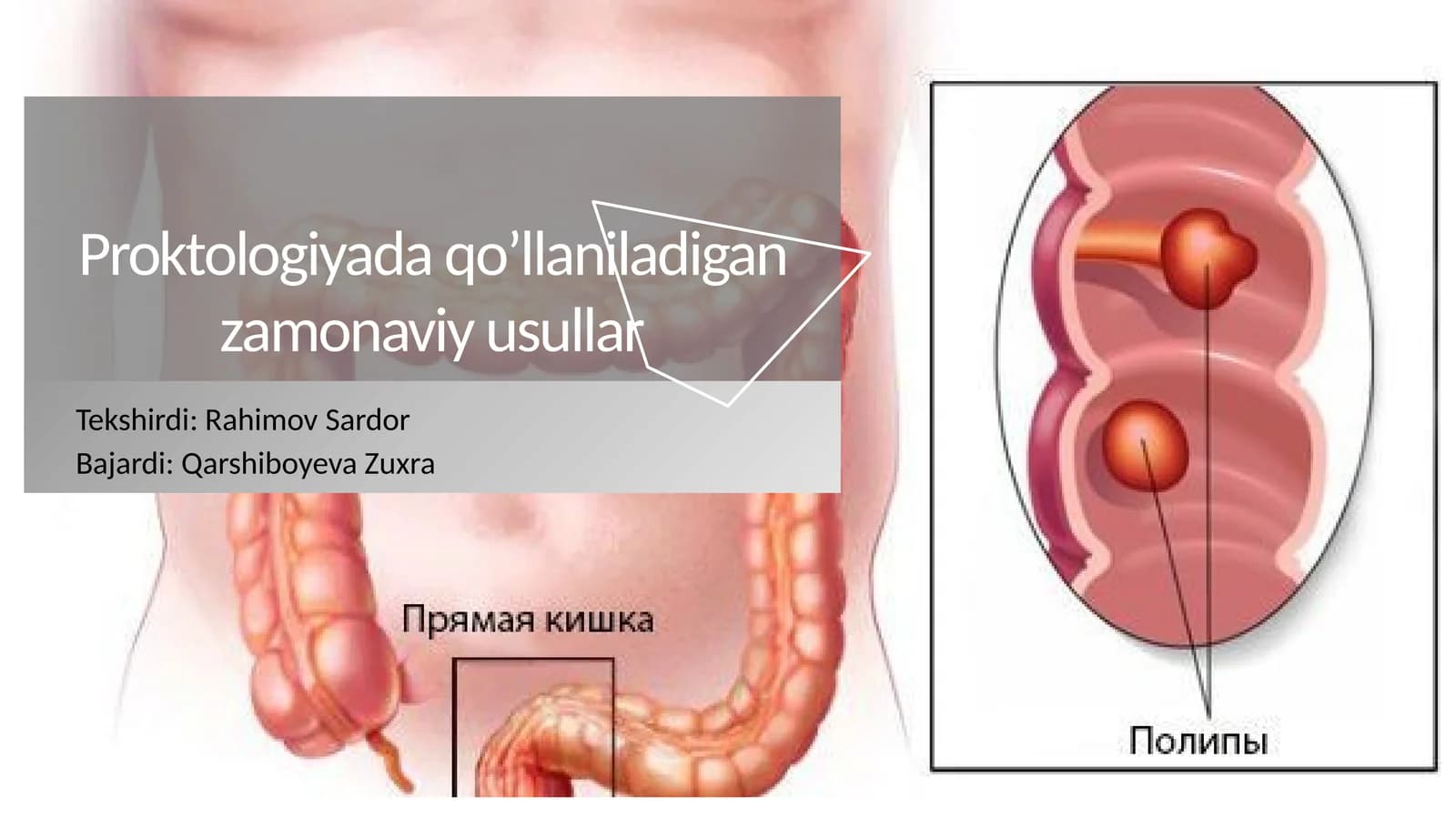 Proktologiyada qo’llaniladigan zamonaviy usullar