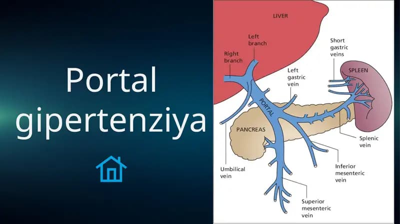 Portal gipertenziya sindromi