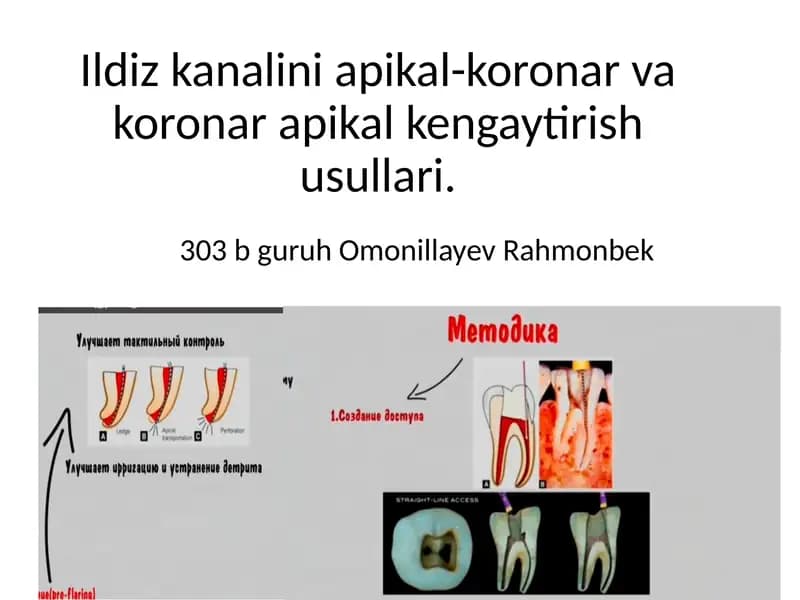 Ildiz kanalini apikal-koronar va koronar apikal kengaytirish usullari.