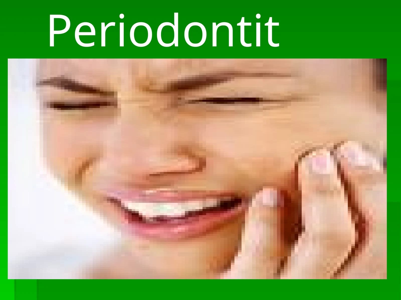 Periodontit