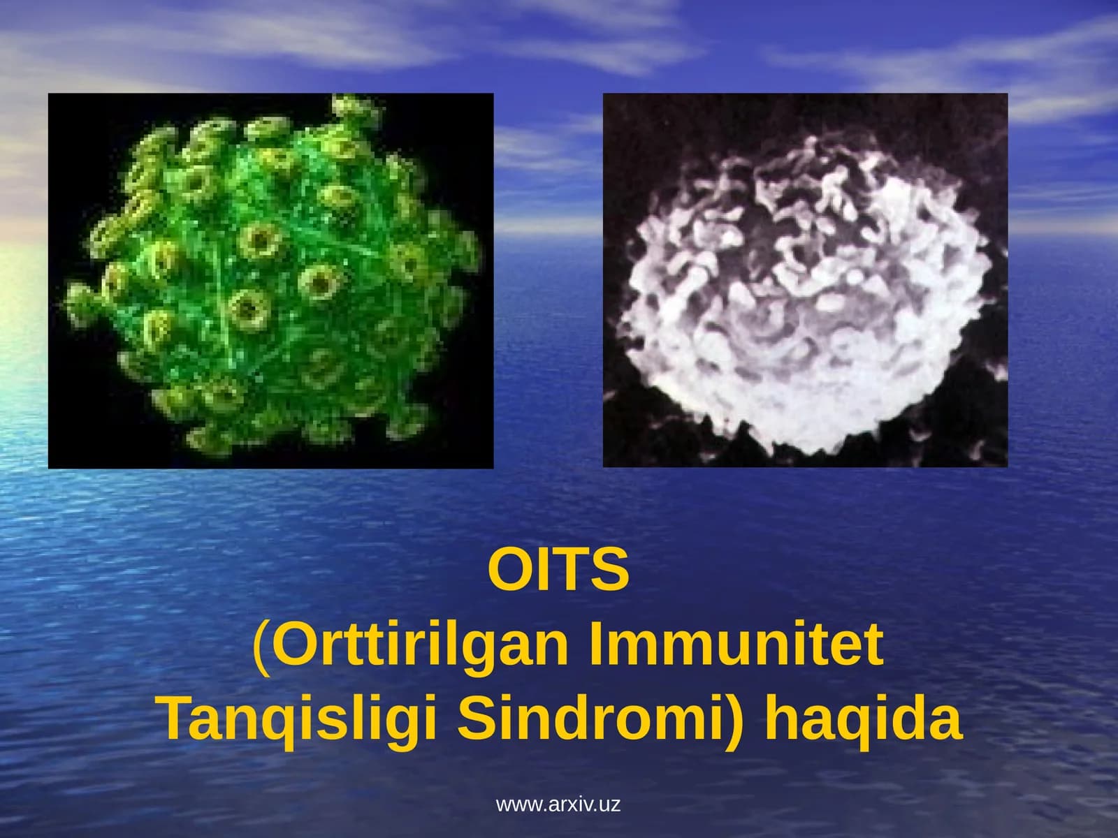 OITS(Orttirilgan Immunitet Tanqisligi Sindromi) haqida