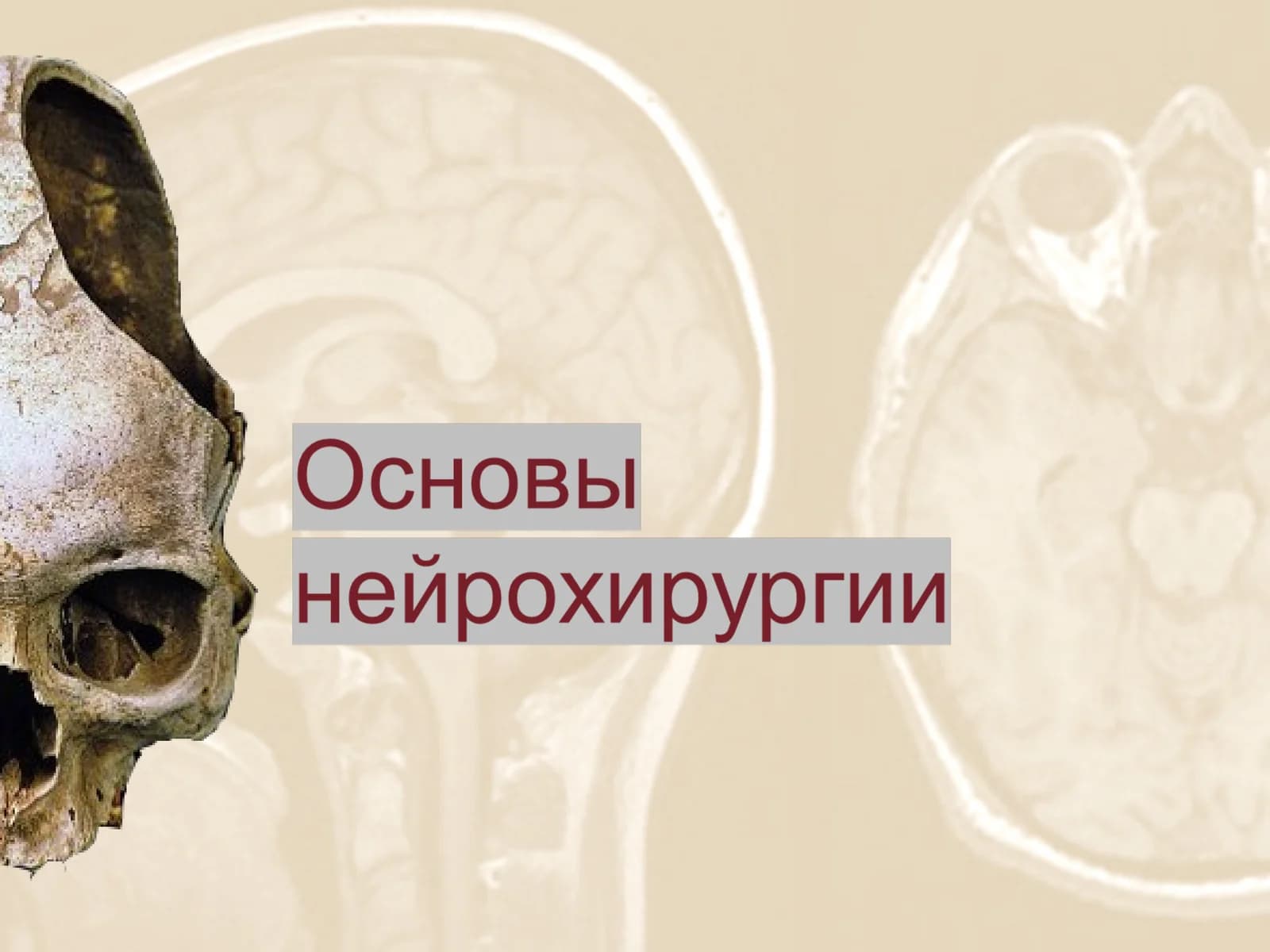 Нейрохирургия
