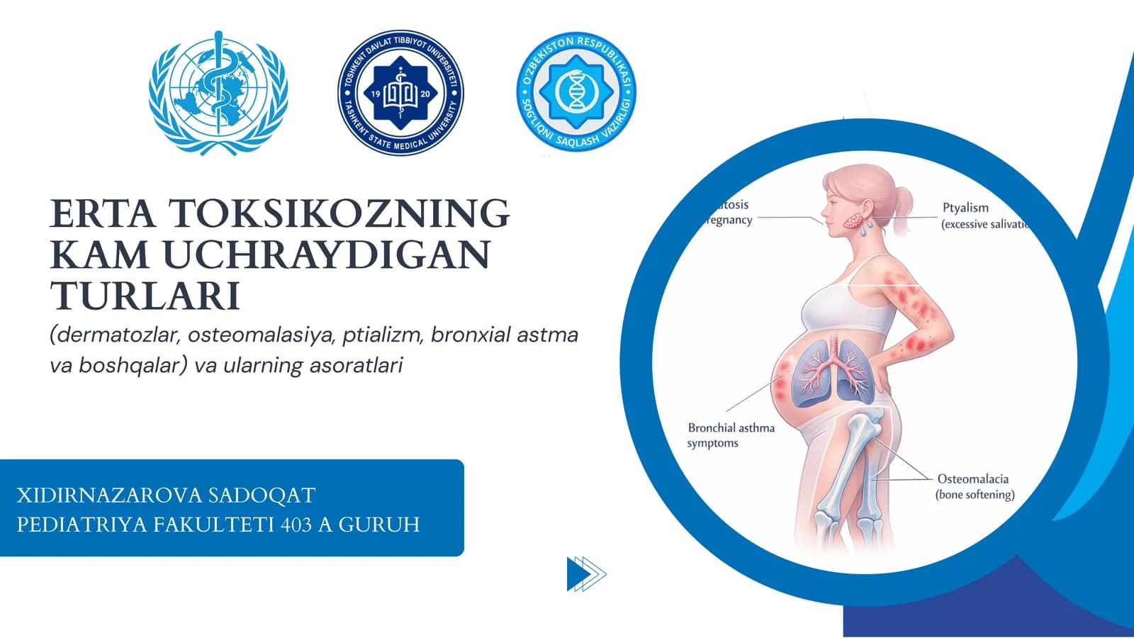 ERTA TOKSIKOZNING KAM UCHRAYDIGAN TURLARI